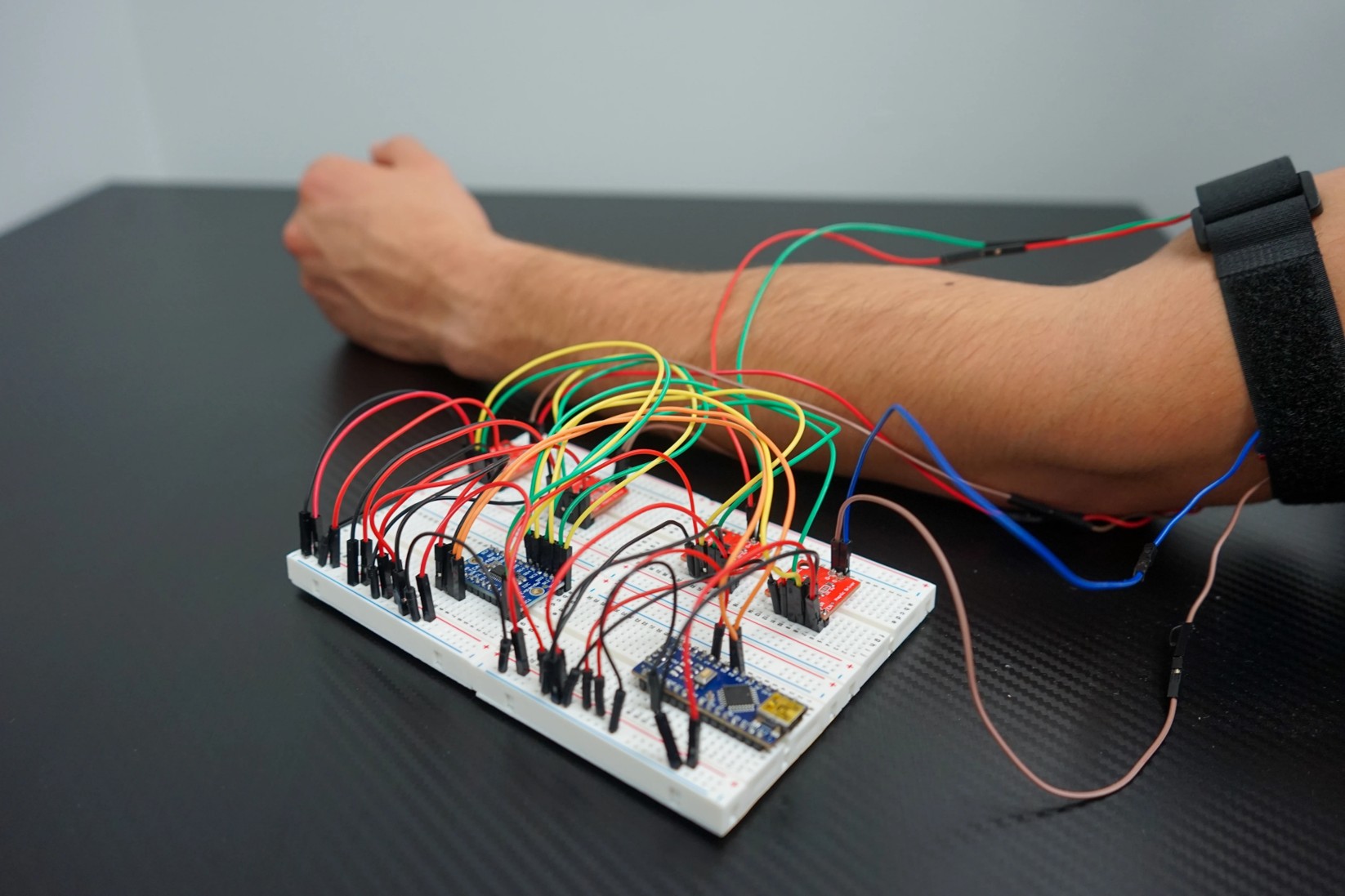 Haptics for Sensory Feedback in Pediatric Prosthetics
